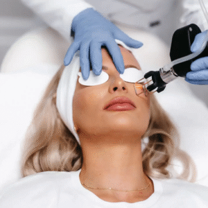 Fractional Laser & PRP Therapy Cost in Dubai